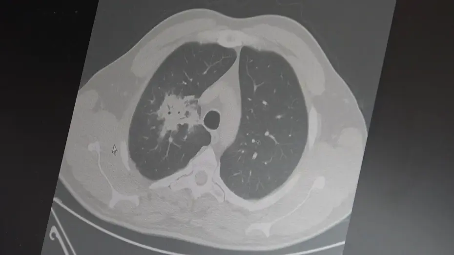 Elektronik Sigaralarda Korkutan Gerçek: Uzun Vadeli Zararlar Ortaya Çıktı